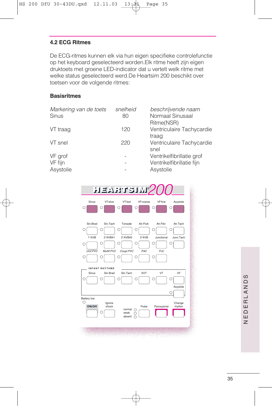 Heartsi m, Nederlands | Laerdal HeartSim 200 User Manual | Page 35 / 86