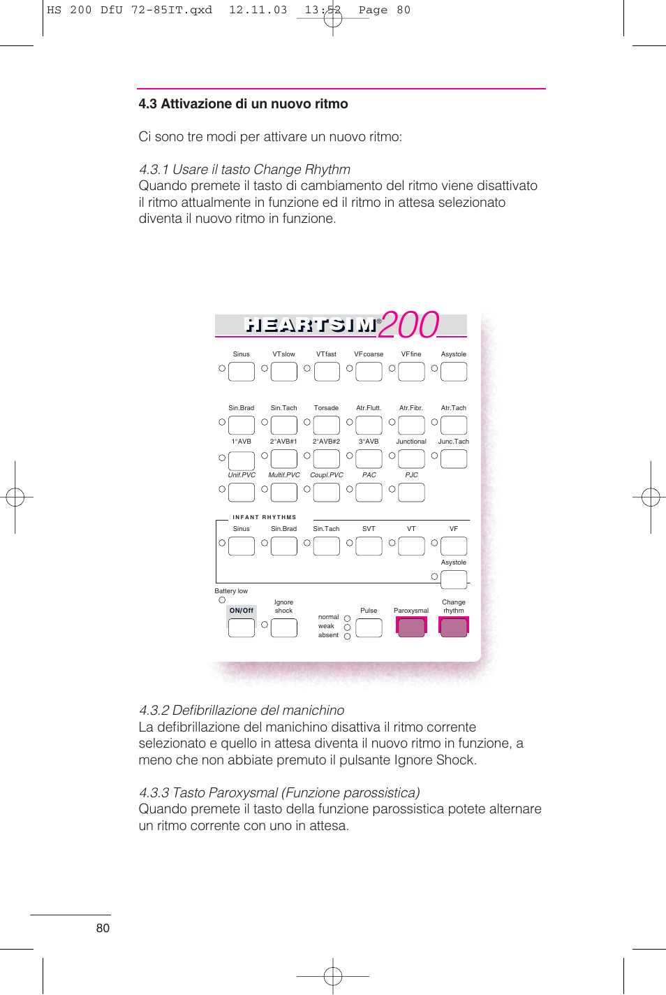 Heartsi m | Laerdal HeartSim 200 User Manual | Page 80 / 86