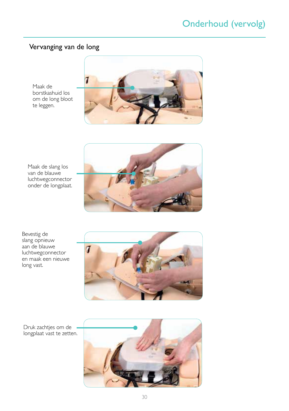 Onderhoud (vervolg) | Laerdal Resusci Anne Advanced SkillTrainer with SimPad User Manual | Page 30 / 100