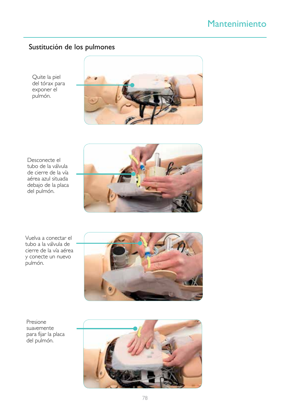 Mantenimiento, Sustitución de los pulmones | Laerdal Resusci Anne Simulator User Manual | Page 78 / 84