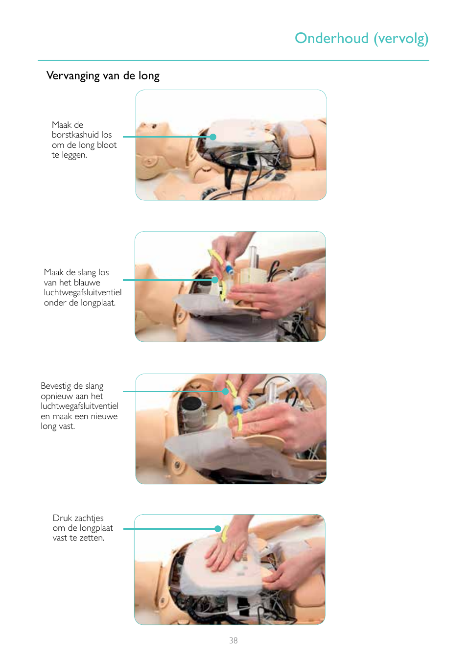 Onderhoud (vervolg), Vervanging van de long | Laerdal Resusci Anne Simulator User Manual | Page 38 / 124