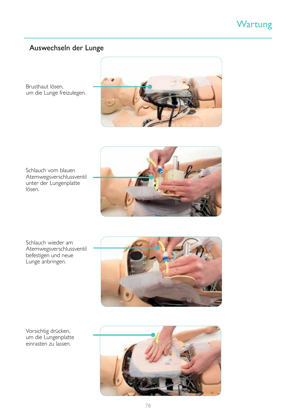 Wartung, Auswechseln der lunge | Laerdal Resusci Anne Simulator User Manual | Page 78 / 124