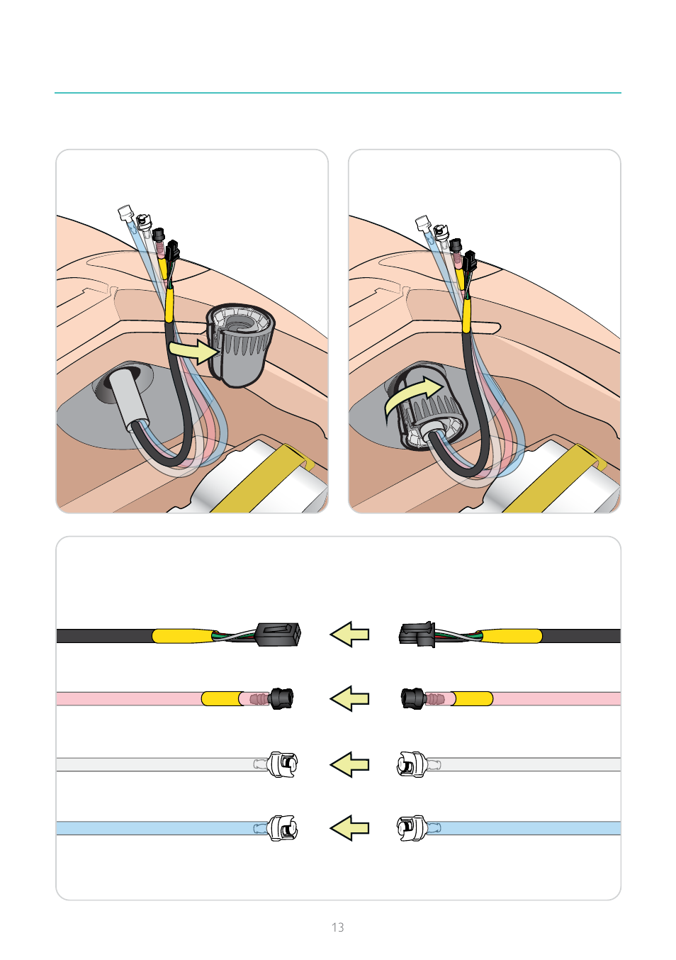 Laerdal SimMan 3G User Manual | Page 13 / 16