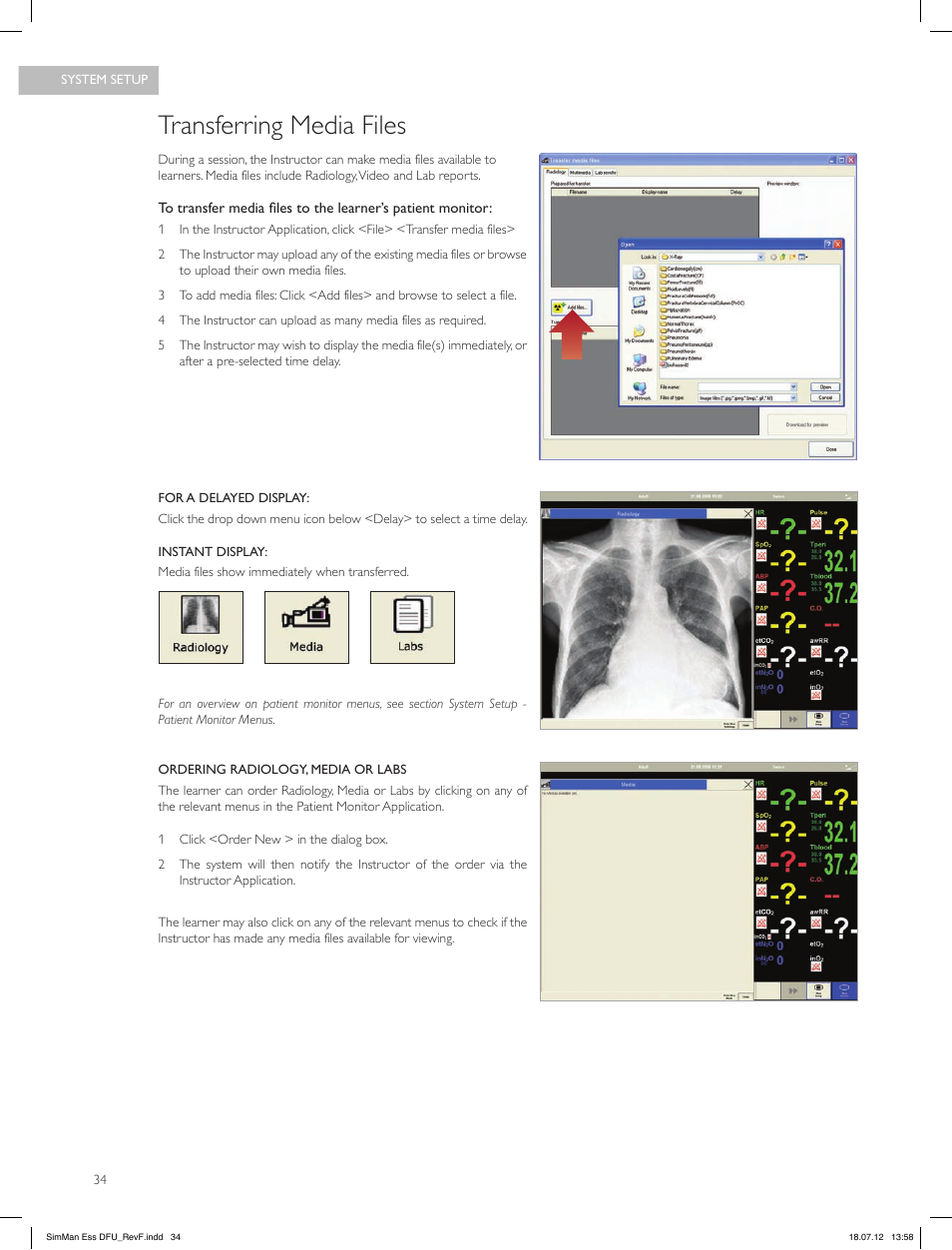 Transferring media files | Laerdal SimMan Essential User Manual | Page 34 / 84