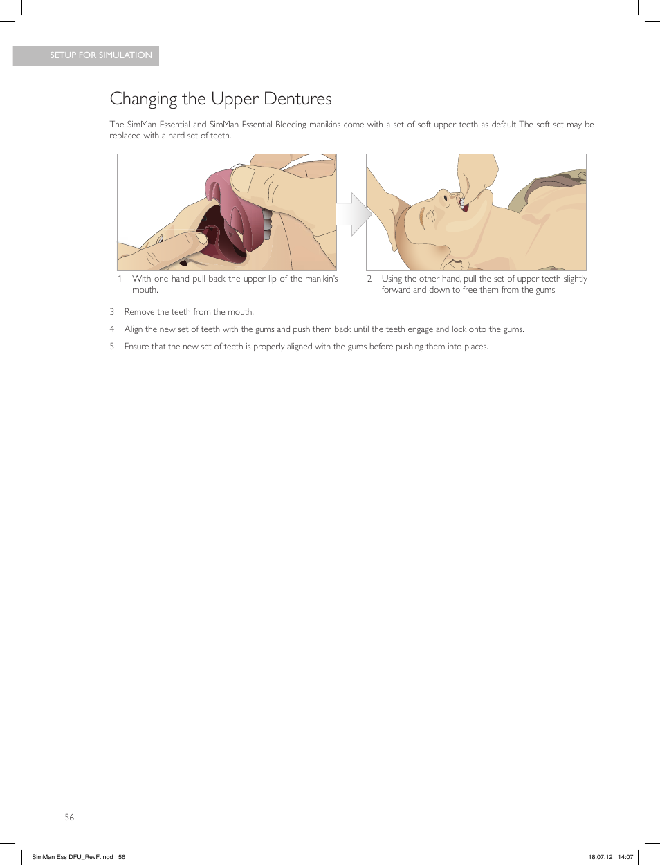 Changing the upper dentures | Laerdal SimMan Essential User Manual | Page 56 / 84