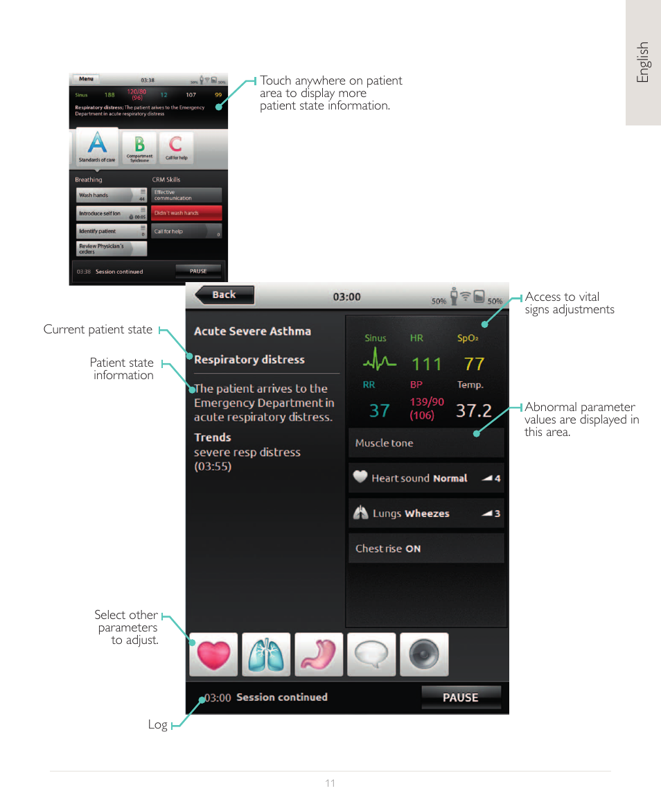Laerdal SimPad User Manual | Page 11 / 36