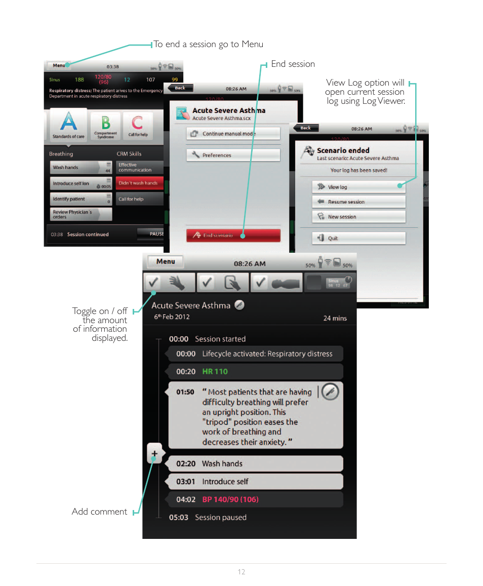Laerdal SimPad User Manual | Page 12 / 36