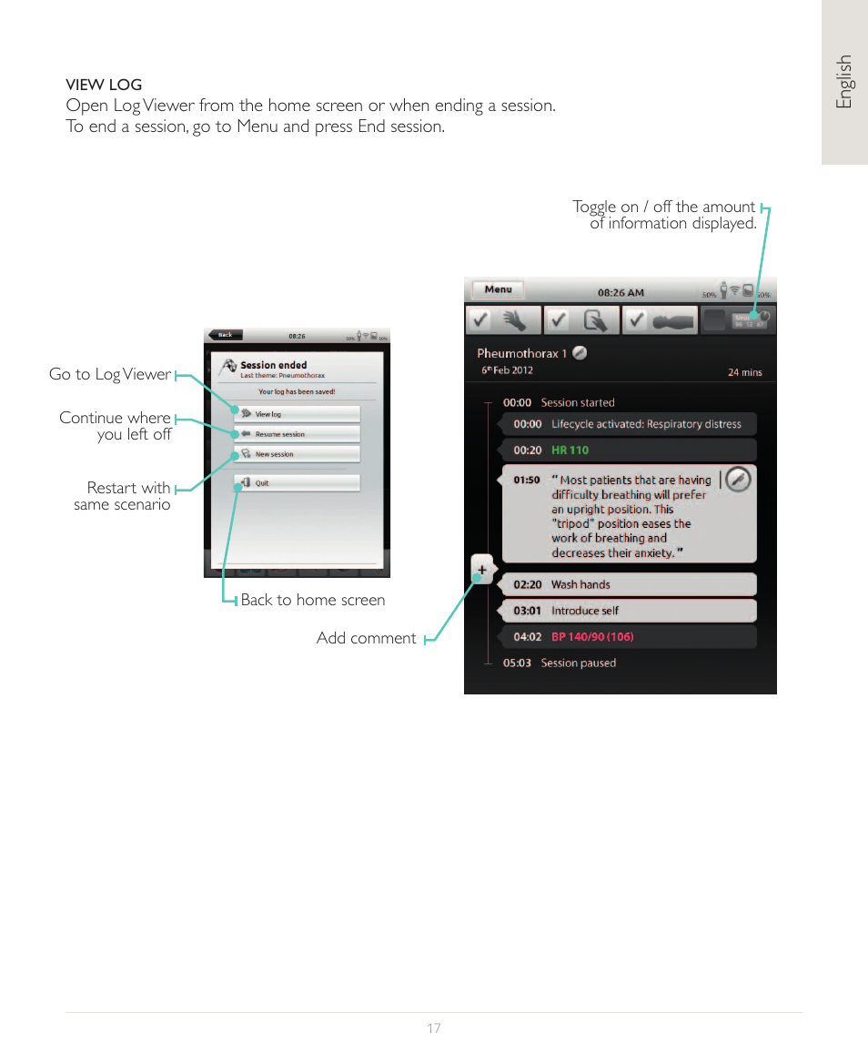 Laerdal SimPad User Manual | Page 17 / 36