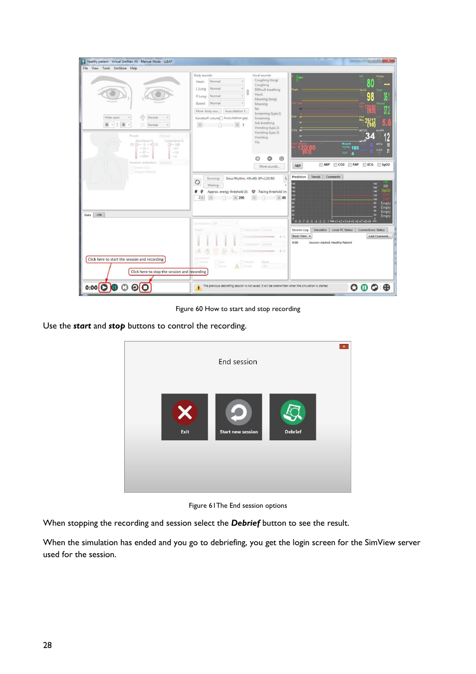 Laerdal SimView User Manual | Page 28 / 48