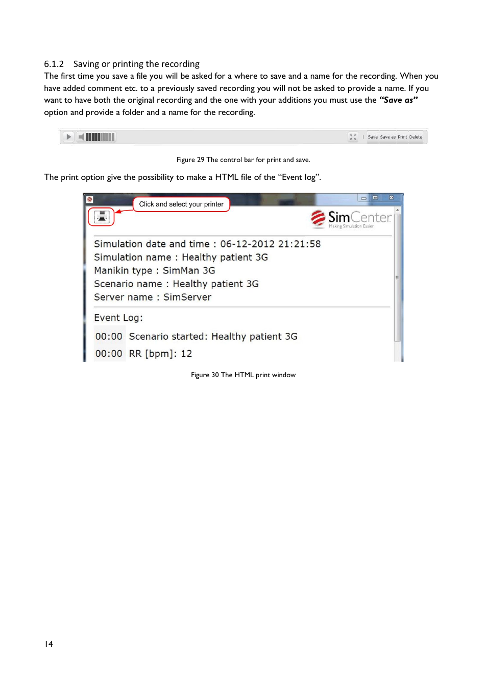 2 saving or printing the recording | Laerdal SimView User Manual | Page 14 / 21
