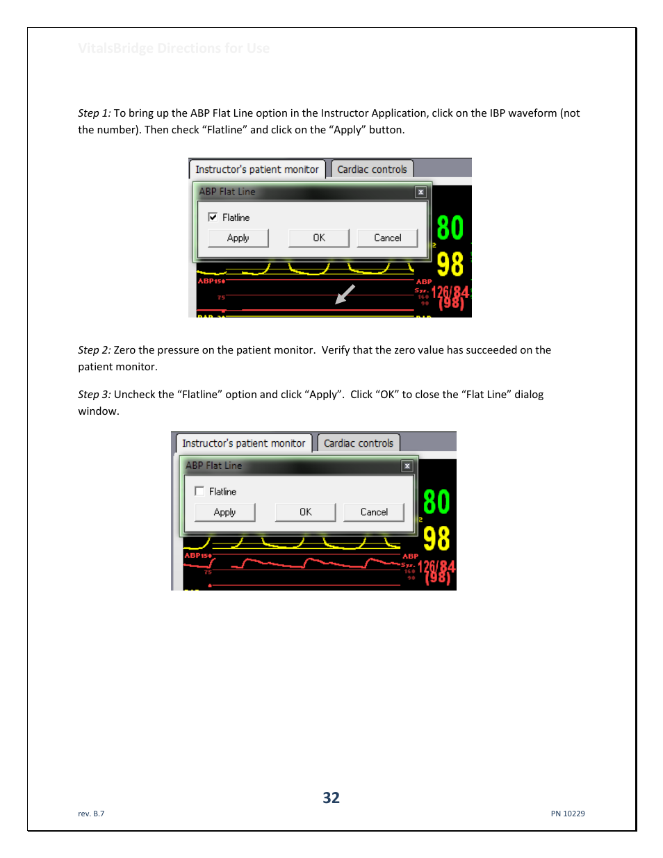 Invasive blood pressure offset, Vitalsbridge directions for use | Laerdal VitalsBridge User Manual | Page 33 / 39