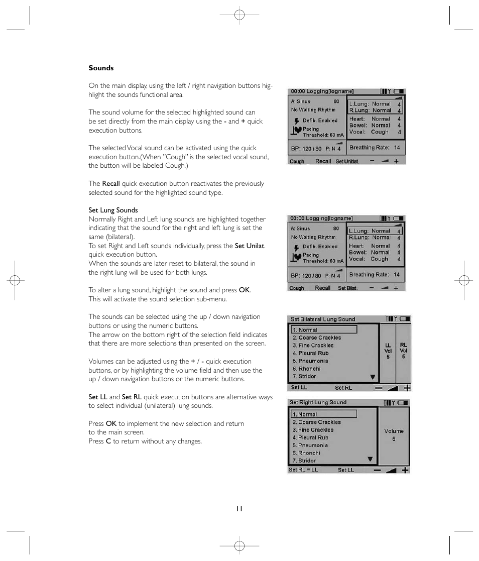 Laerdal VitalSim User Manual | Page 11 / 100