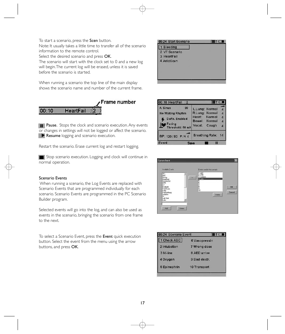 Laerdal VitalSim User Manual | Page 17 / 100