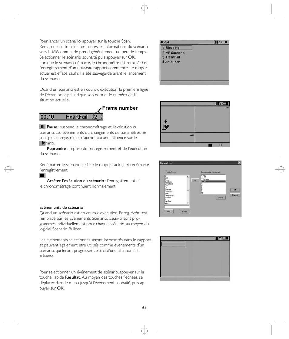 Laerdal VitalSim User Manual | Page 65 / 100