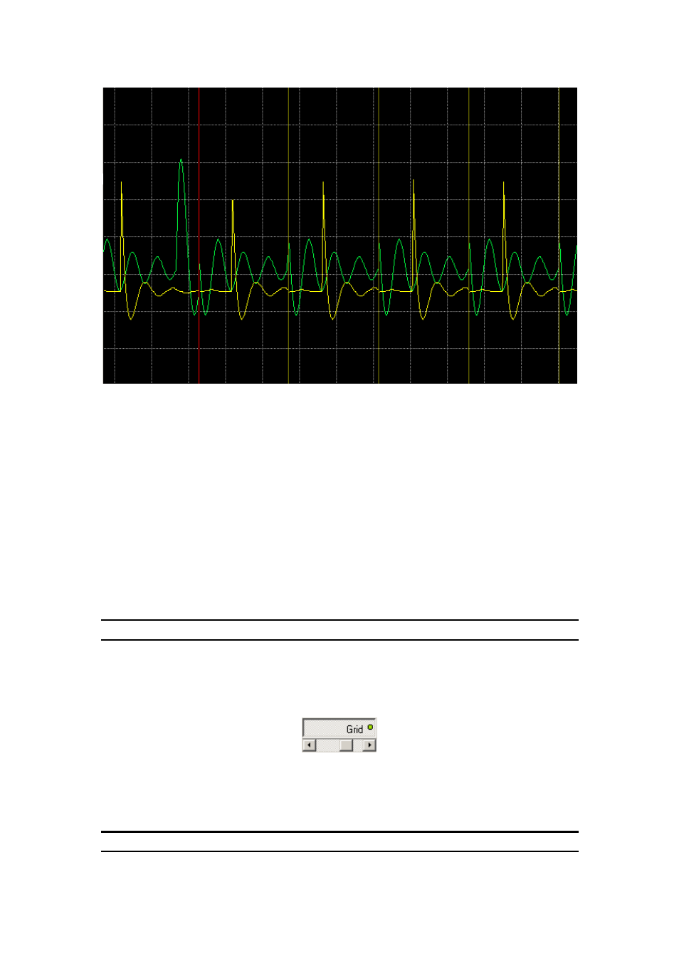 Grid controls | Dataman 520 Series User Manual | Page 13 / 39