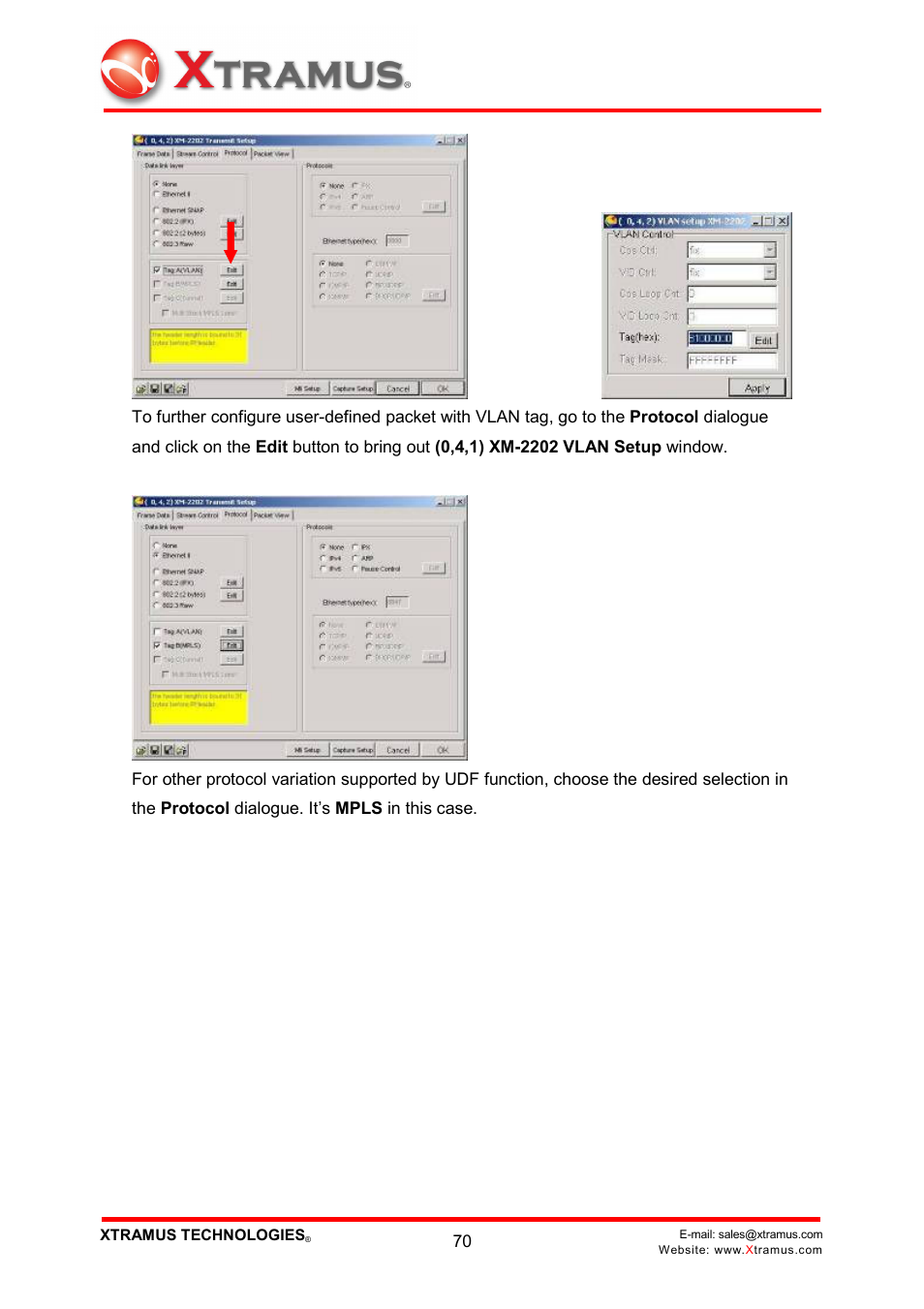 Xtramus NuWIN V1.1 User Manual | Page 75 / 171