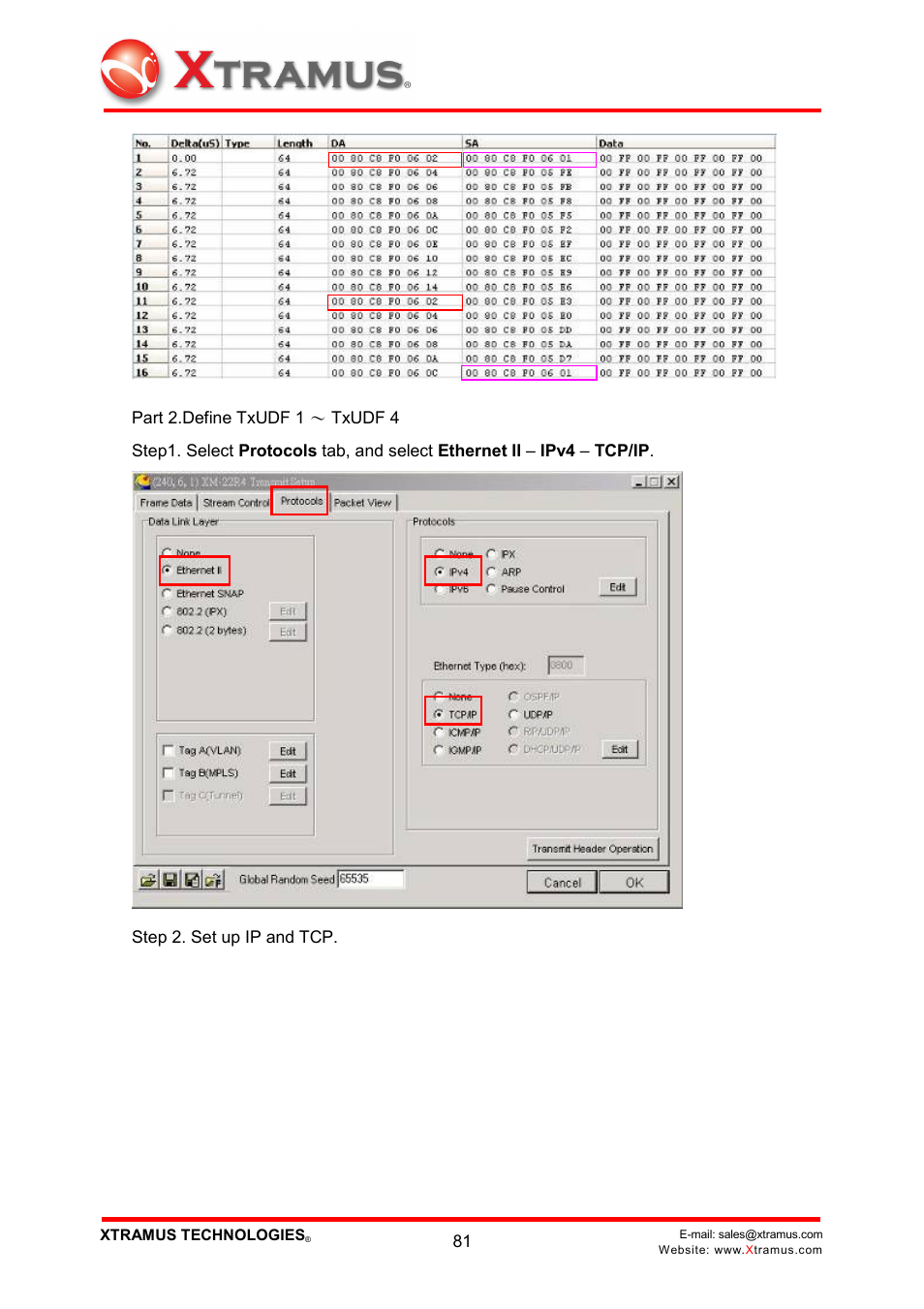 Xtramus NuWIN V1.1 User Manual | Page 86 / 171