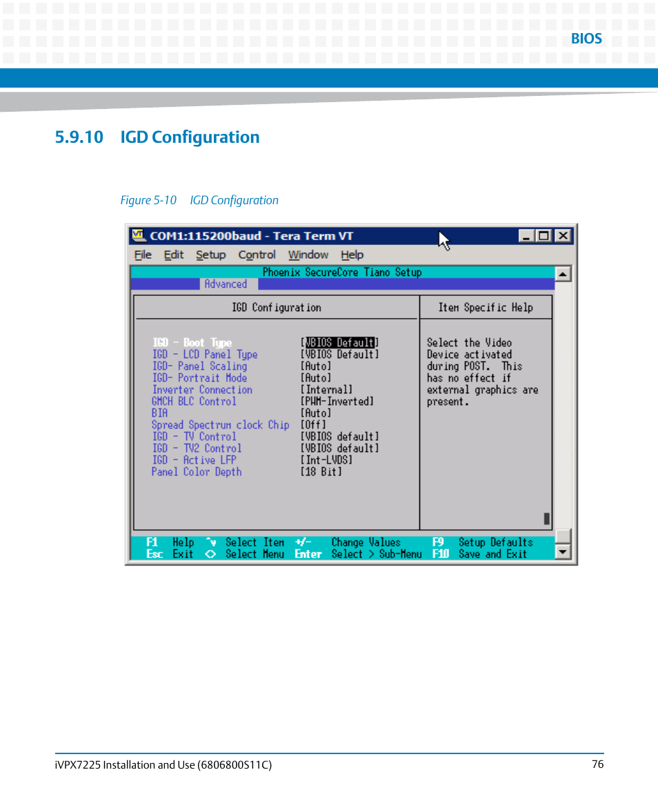 10 igd configuration, Figure 5-10, Igd configuration | Artesyn iVPX7225 Installation and Use (April 2015) User Manual | Page 95 / 168