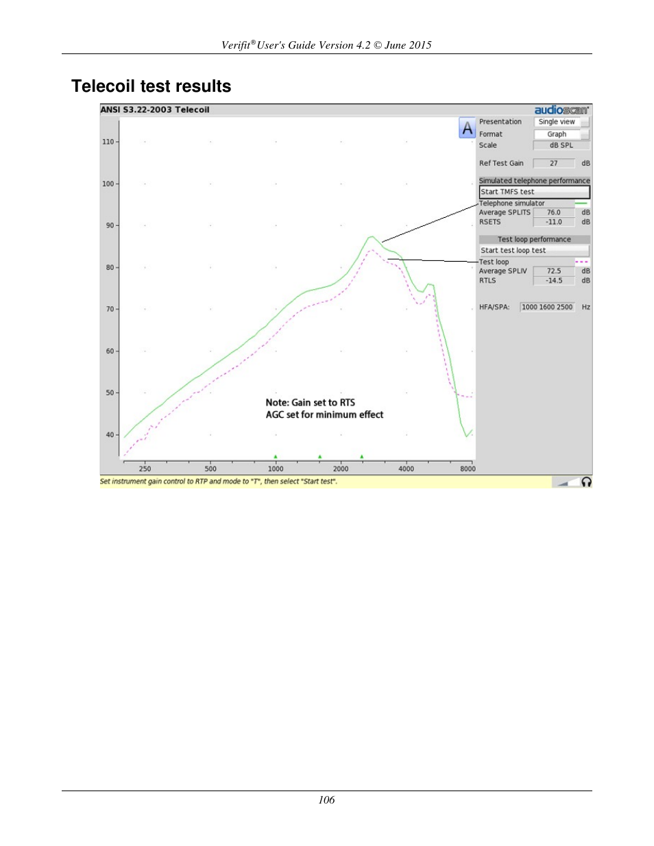 Telecoil test results | Audioscan Verifit 2 User Manual | Page 106 / 156