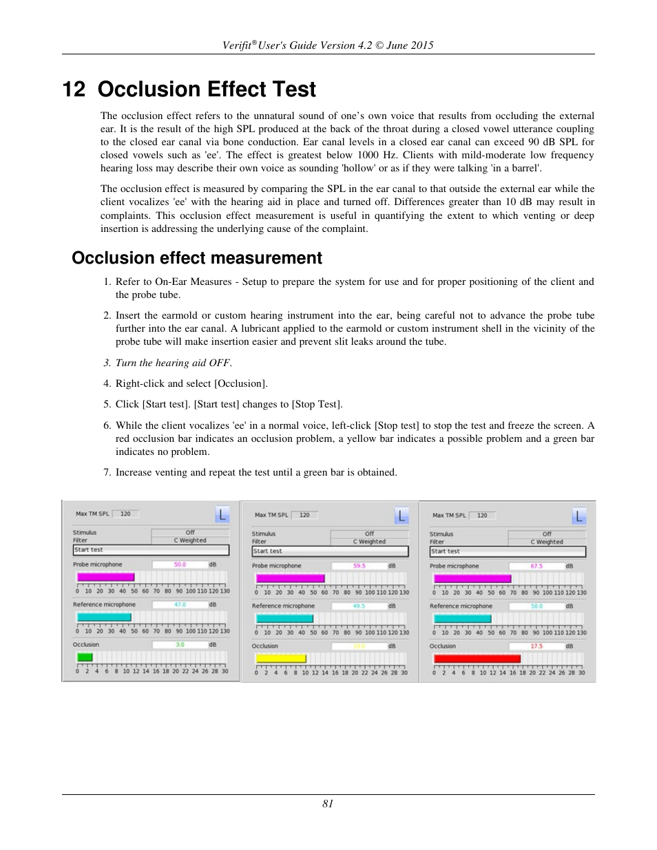 12 occlusion effect test, Occlusion effect measurement | Audioscan Verifit 2 User Manual | Page 81 / 156