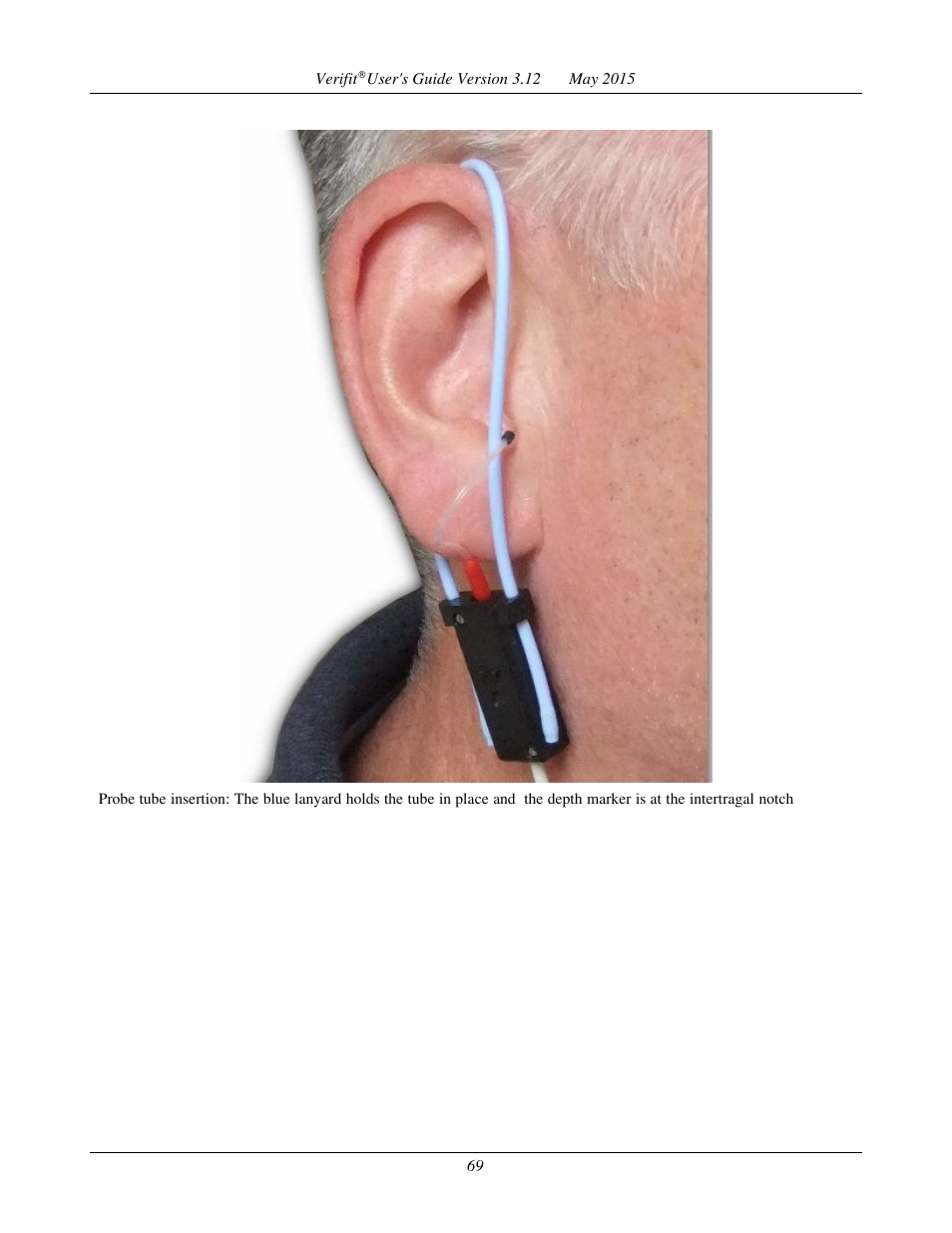 Audioscan Verifit User Manual | Page 69 / 155
