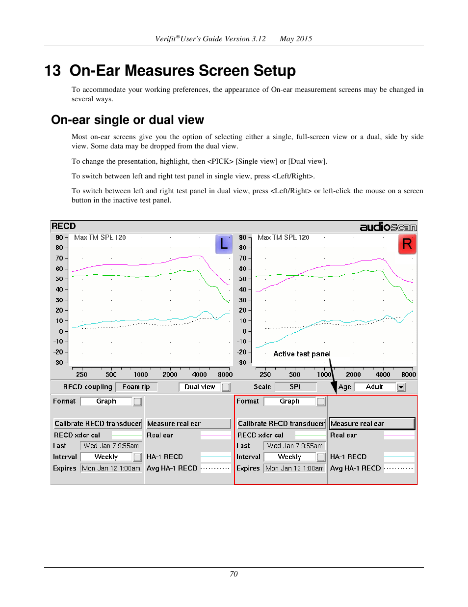 13 on-ear measures screen setup, On-ear single or dual view | Audioscan Verifit User Manual | Page 70 / 155