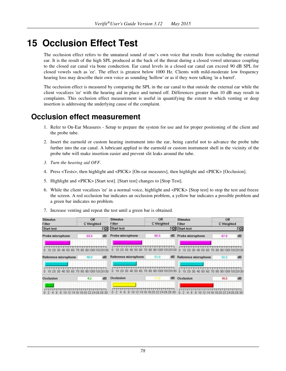 15 occlusion effect test, Occlusion effect measurement | Audioscan Verifit User Manual | Page 78 / 155