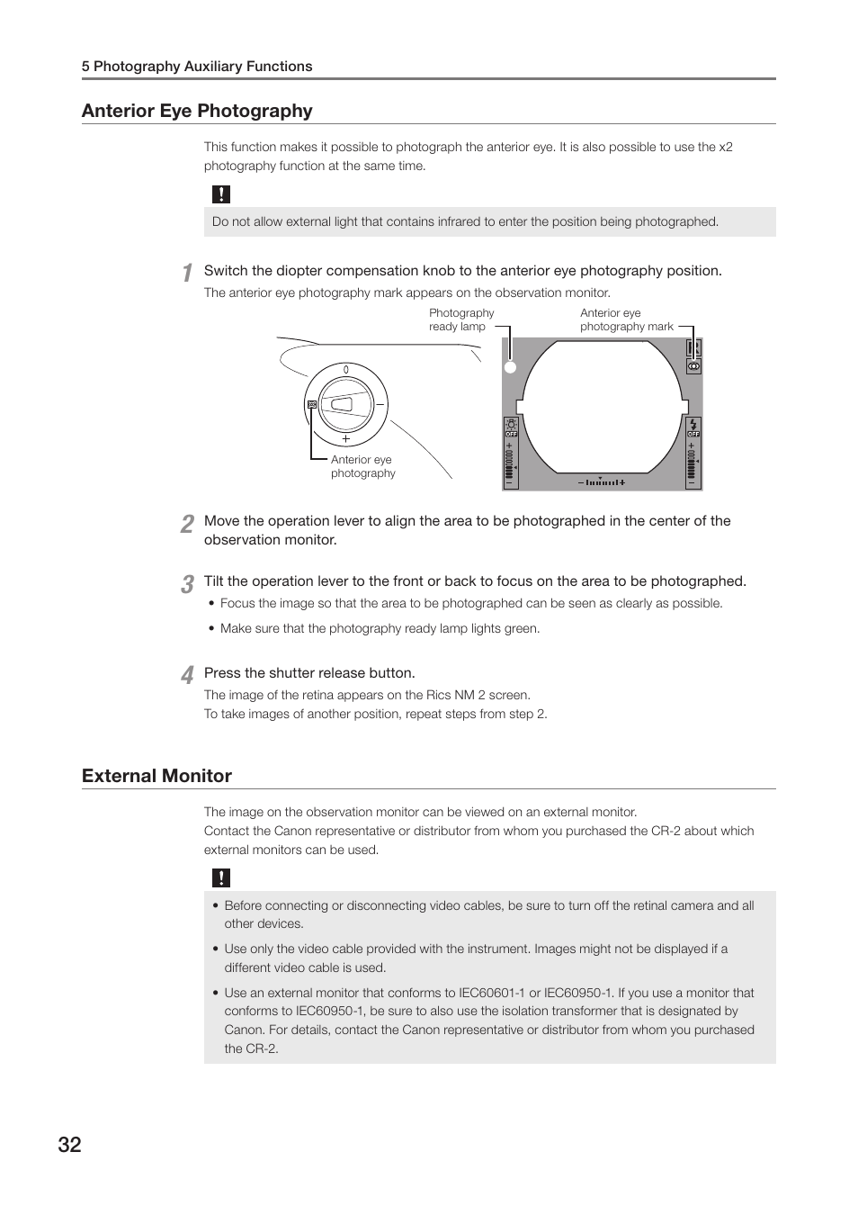 Anterior eye photography, External monitor, Anterior eye photography external monitor | Canon CR-2 User Manual | Page 32 / 48