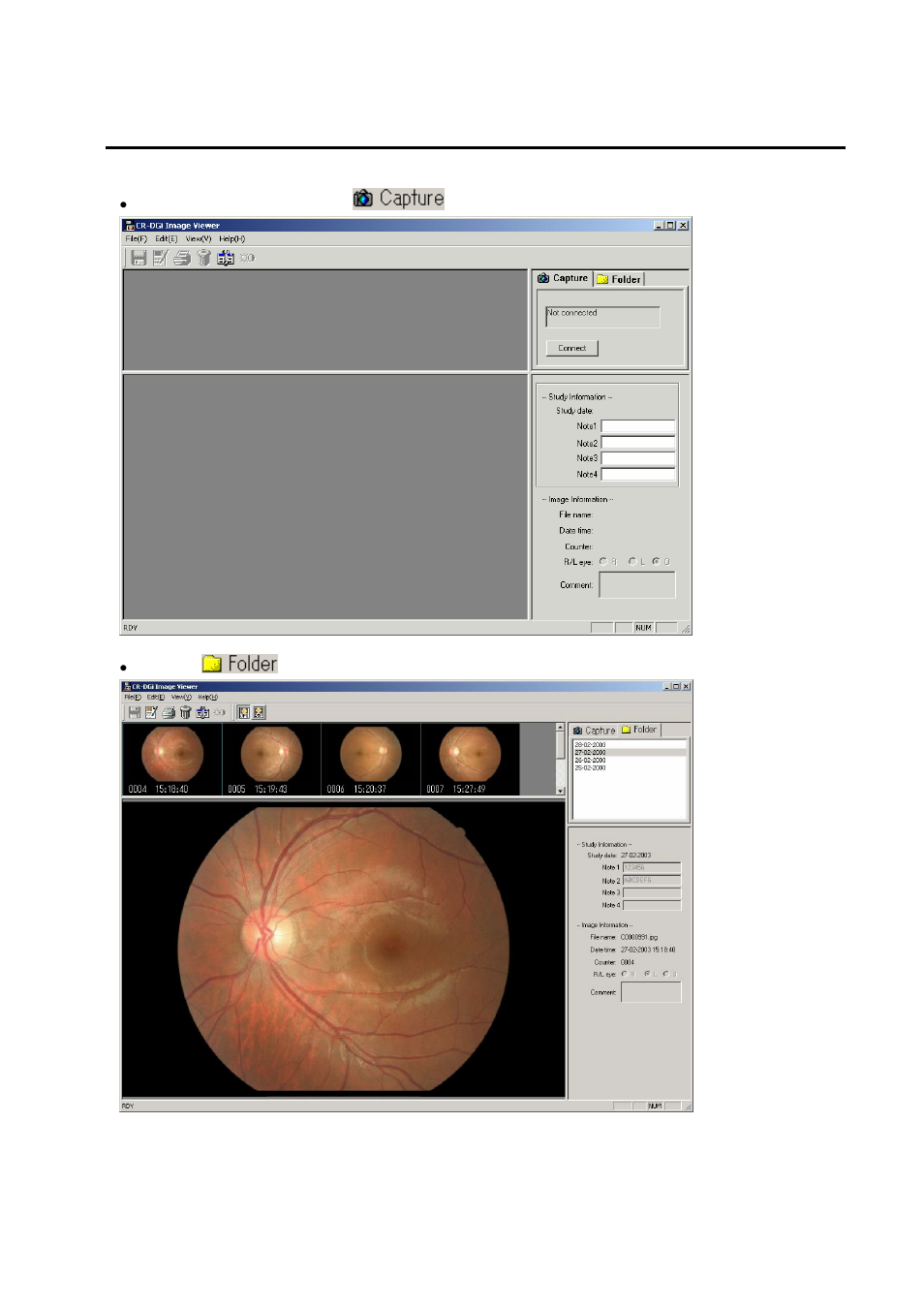 Screen operations | Canon CR-DGi User Manual | Page 15 / 32