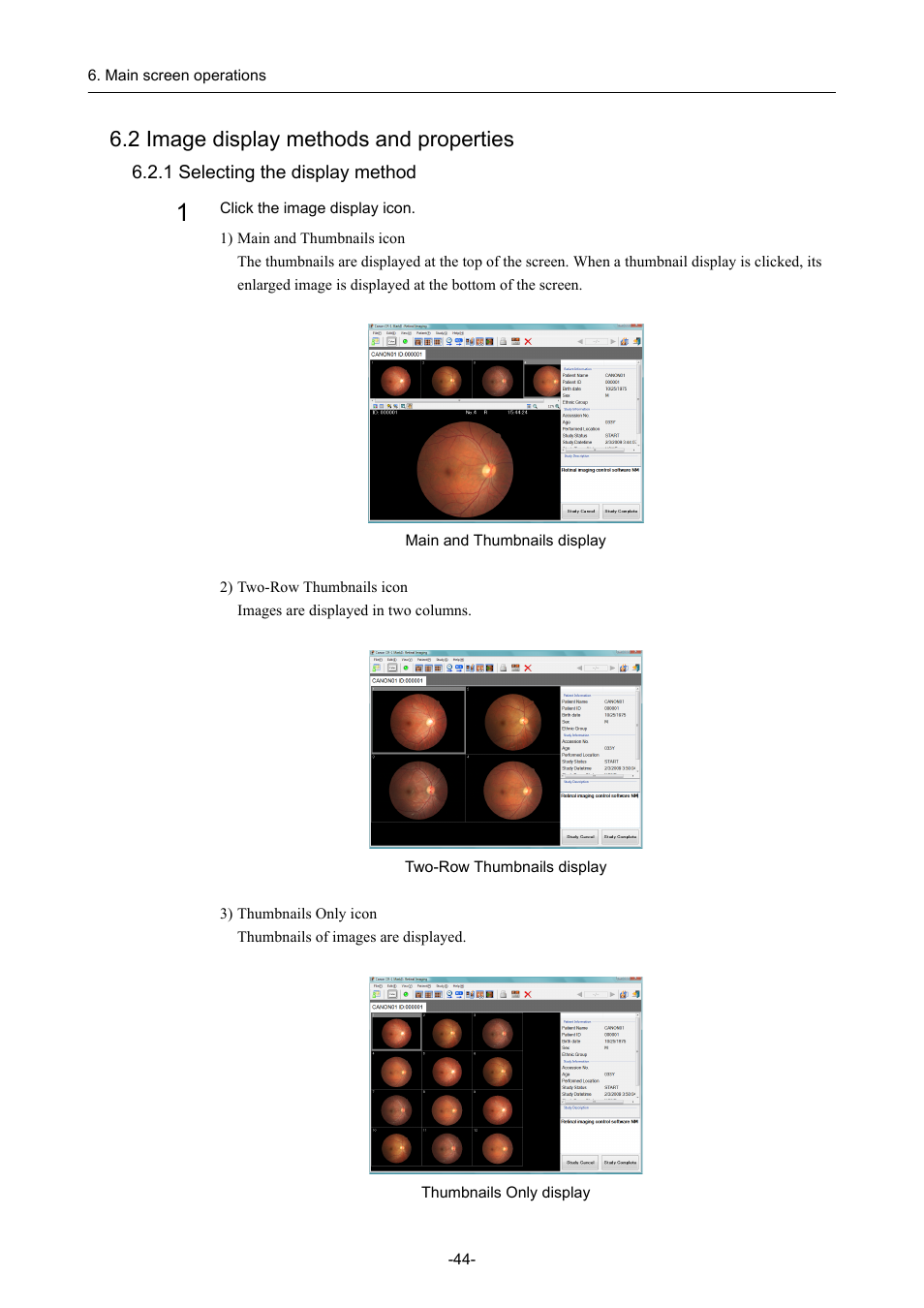 2 image display methods and properties, 1 selecting the display method | Canon CR-1 MARK II User Manual | Page 52 / 138