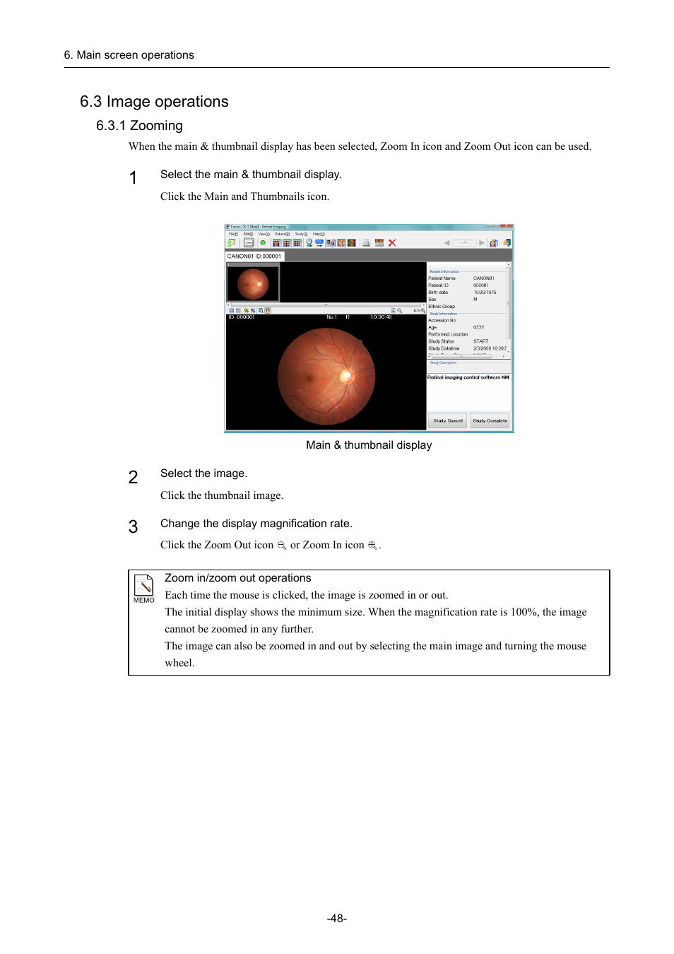 3 image operations, 1 zooming | Canon CR-1 MARK II User Manual | Page 56 / 138