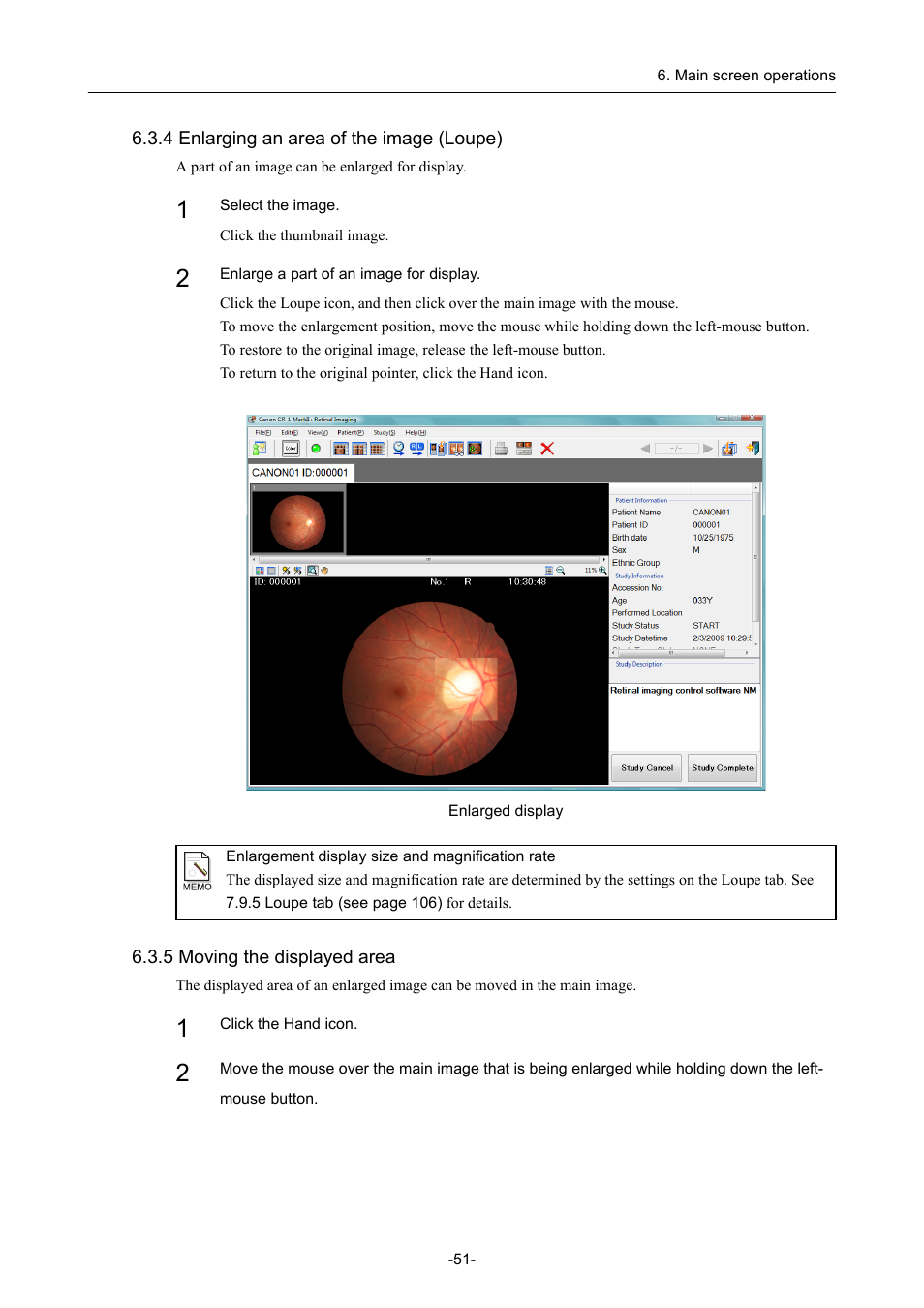 4 enlarging an area of the image (loupe), 5 moving the displayed area | Canon CR-1 MARK II User Manual | Page 59 / 138
