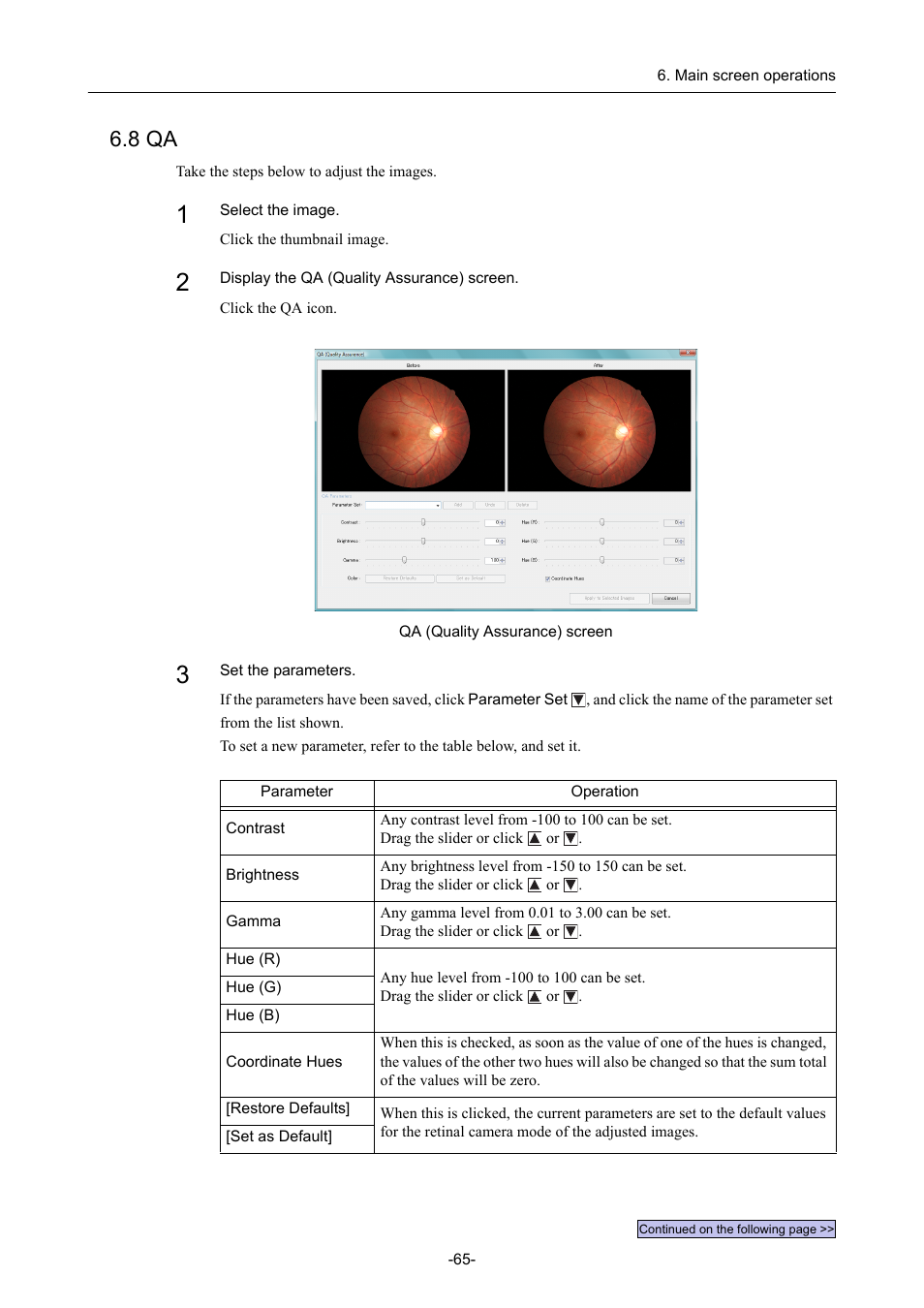 8 qa | Canon CR-1 MARK II User Manual | Page 73 / 138