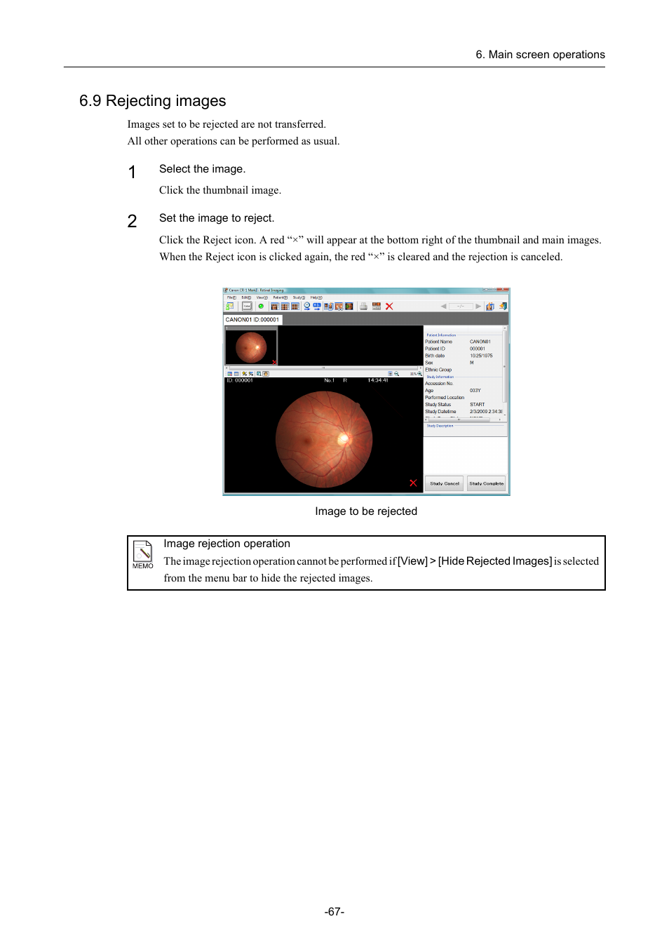 9 rejecting images | Canon CR-1 MARK II User Manual | Page 75 / 138