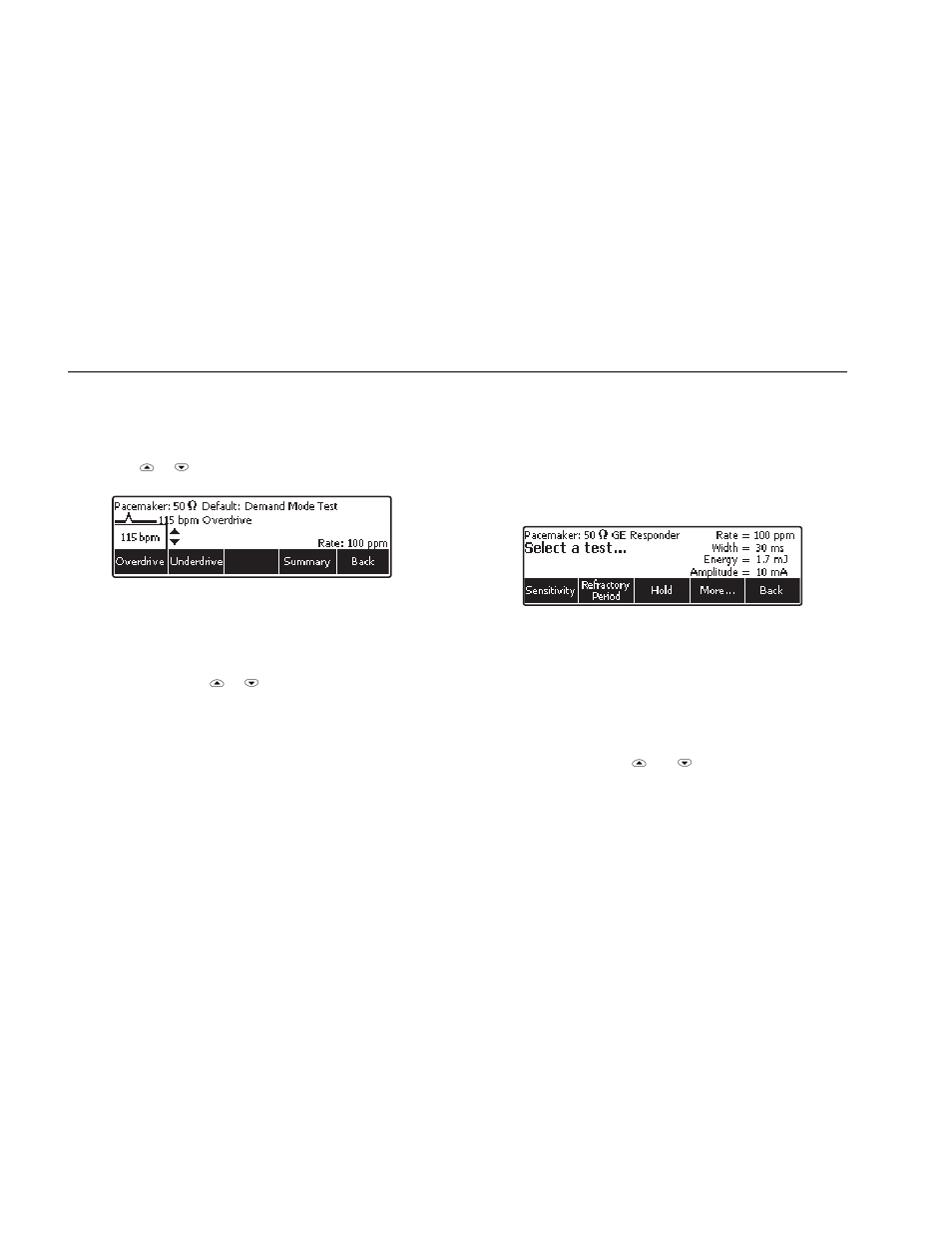 Performing a pacer sensitivity test | Fluke Biomedical 6000D Impulse User Manual | Page 30 / 92