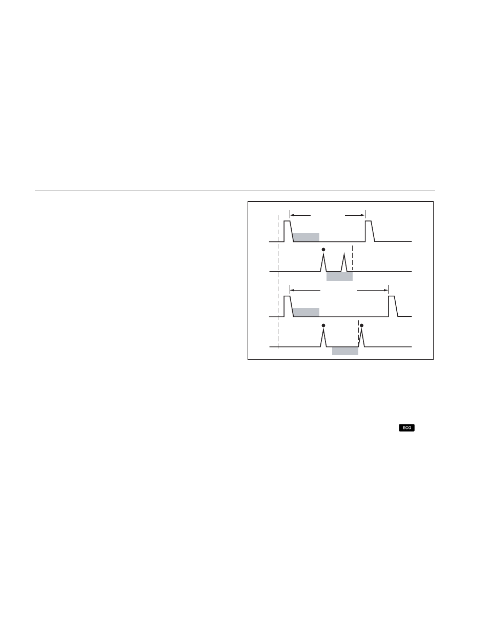 Sensed refractory period (srp), Simulating ecg signals | Fluke Biomedical 6000D Impulse User Manual | Page 32 / 92