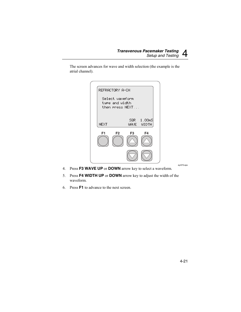 Fluke Biomedical SigmaPace 1000 User Manual | Page 107 / 154