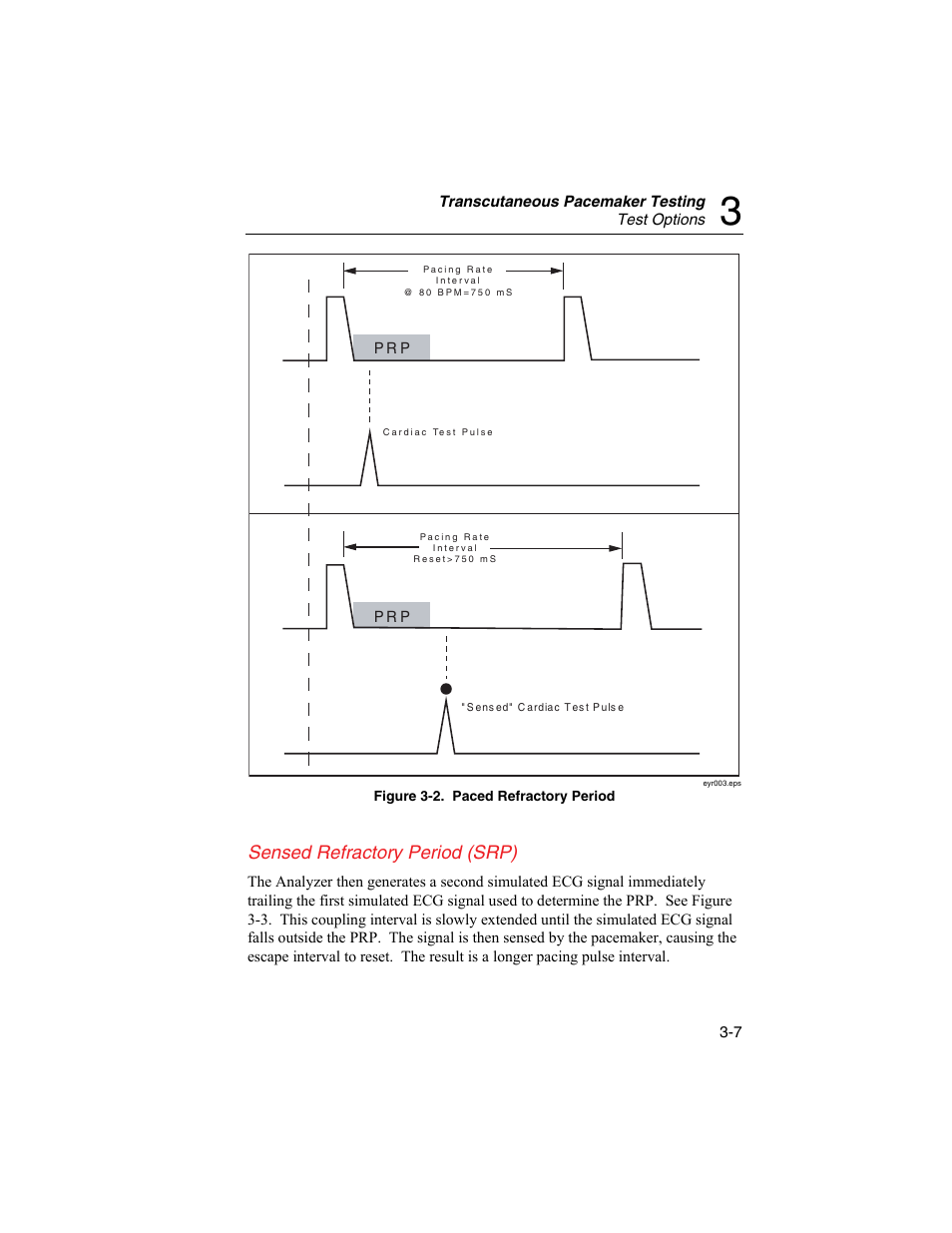 Sensed refractory period (srp) | Fluke Biomedical SigmaPace 1000 User Manual | Page 61 / 154