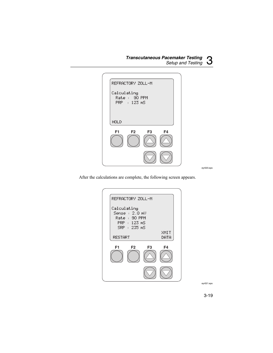 Fluke Biomedical SigmaPace 1000 User Manual | Page 73 / 154