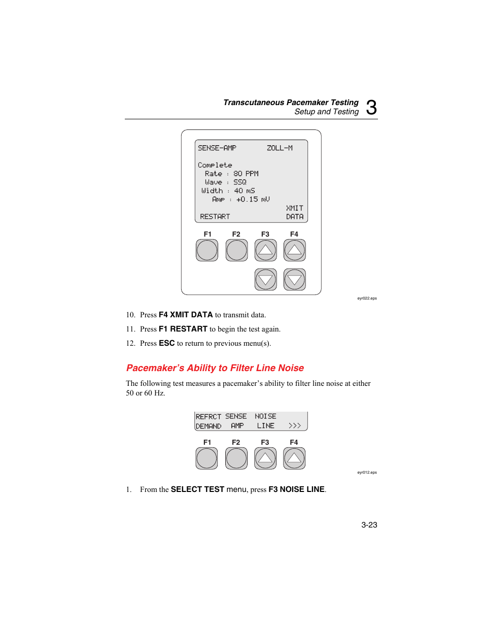Pacemaker's ability to filter line noise | Fluke Biomedical SigmaPace 1000 User Manual | Page 77 / 154