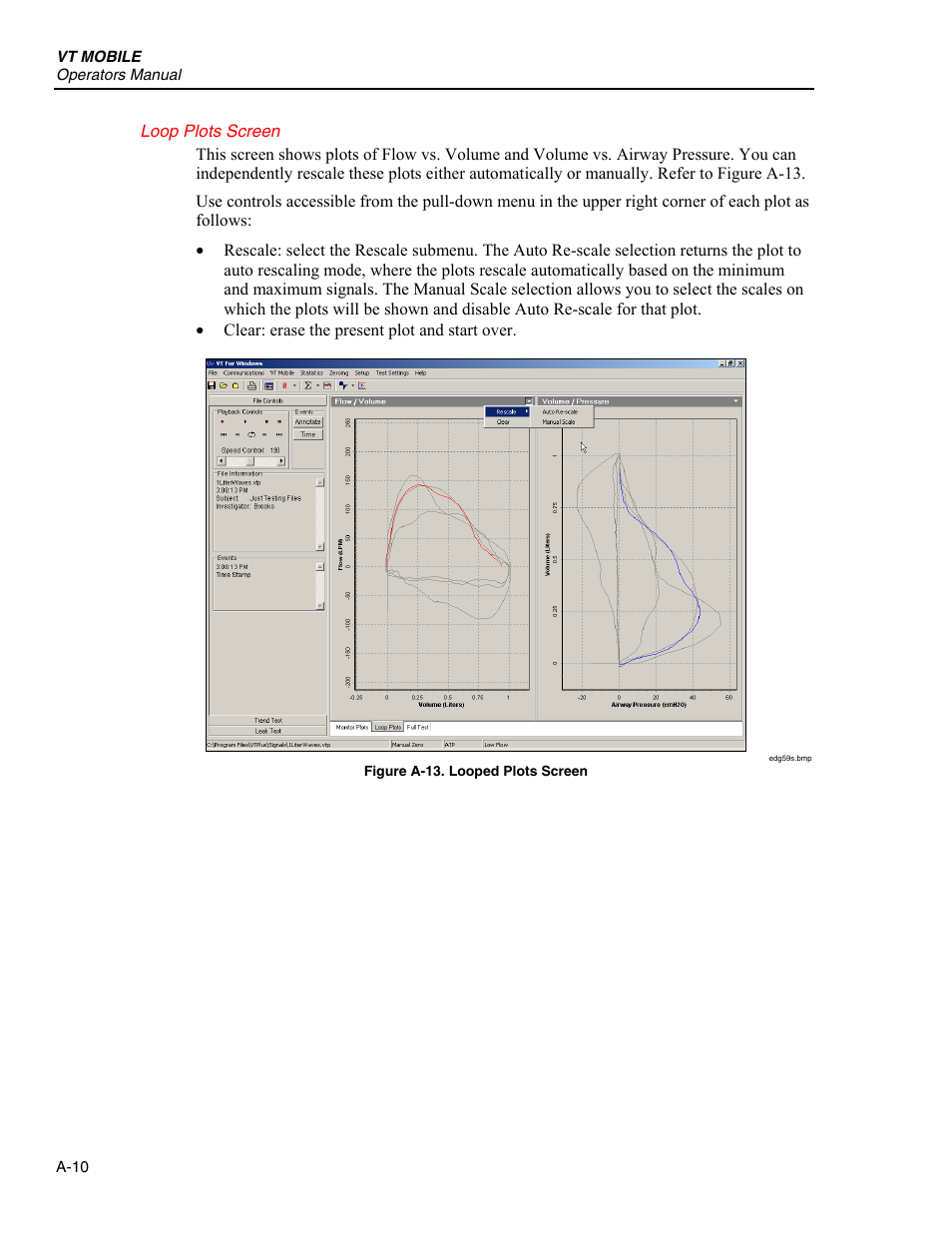 Loop plots screen | Fluke Biomedical VT Mobile User Manual | Page 76 / 104