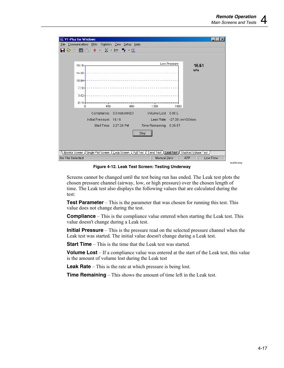 Fluke Biomedical VT Plus HF User Manual | Page 101 / 142