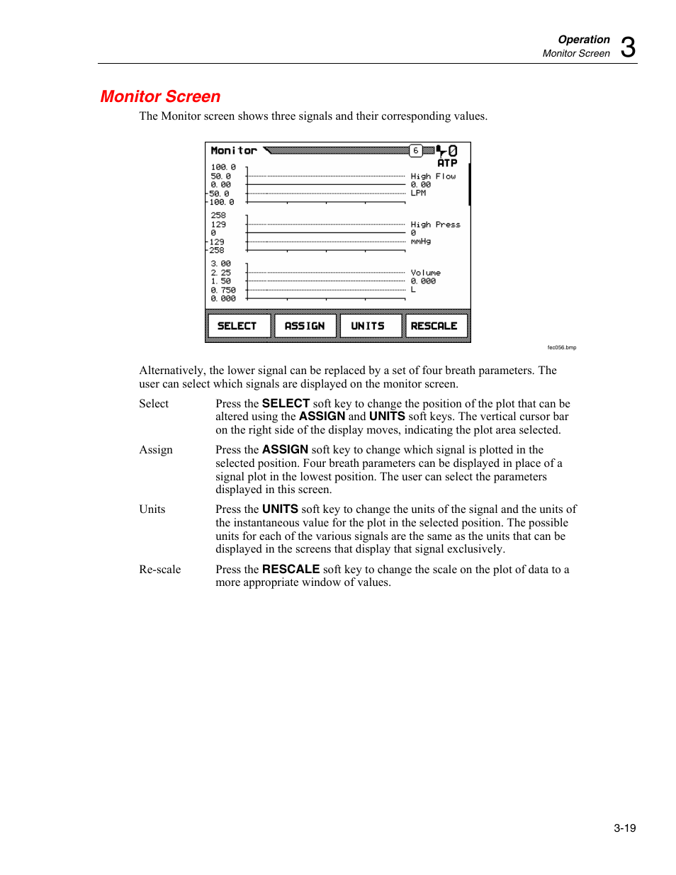 Monitor screen | Fluke Biomedical VT Plus HF User Manual | Page 69 / 142