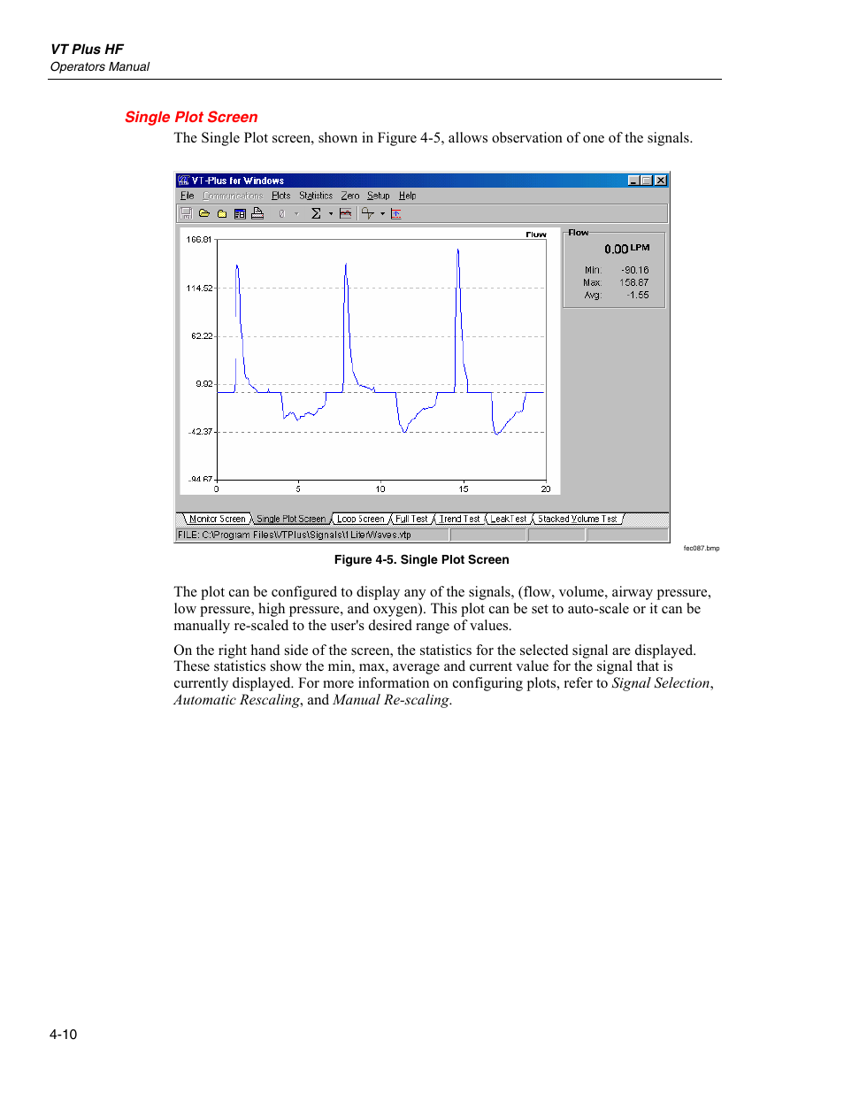 Single plot screen | Fluke Biomedical VT Plus HF User Manual | Page 94 / 142