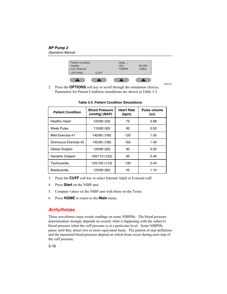 Arrhythmias | Fluke Biomedical BP Pump 2 User Manual | Page 52 / 82