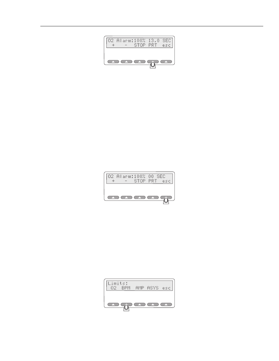 Simulating the pulse rate | Fluke Biomedical 2MF Index User Manual | Page 45 / 126