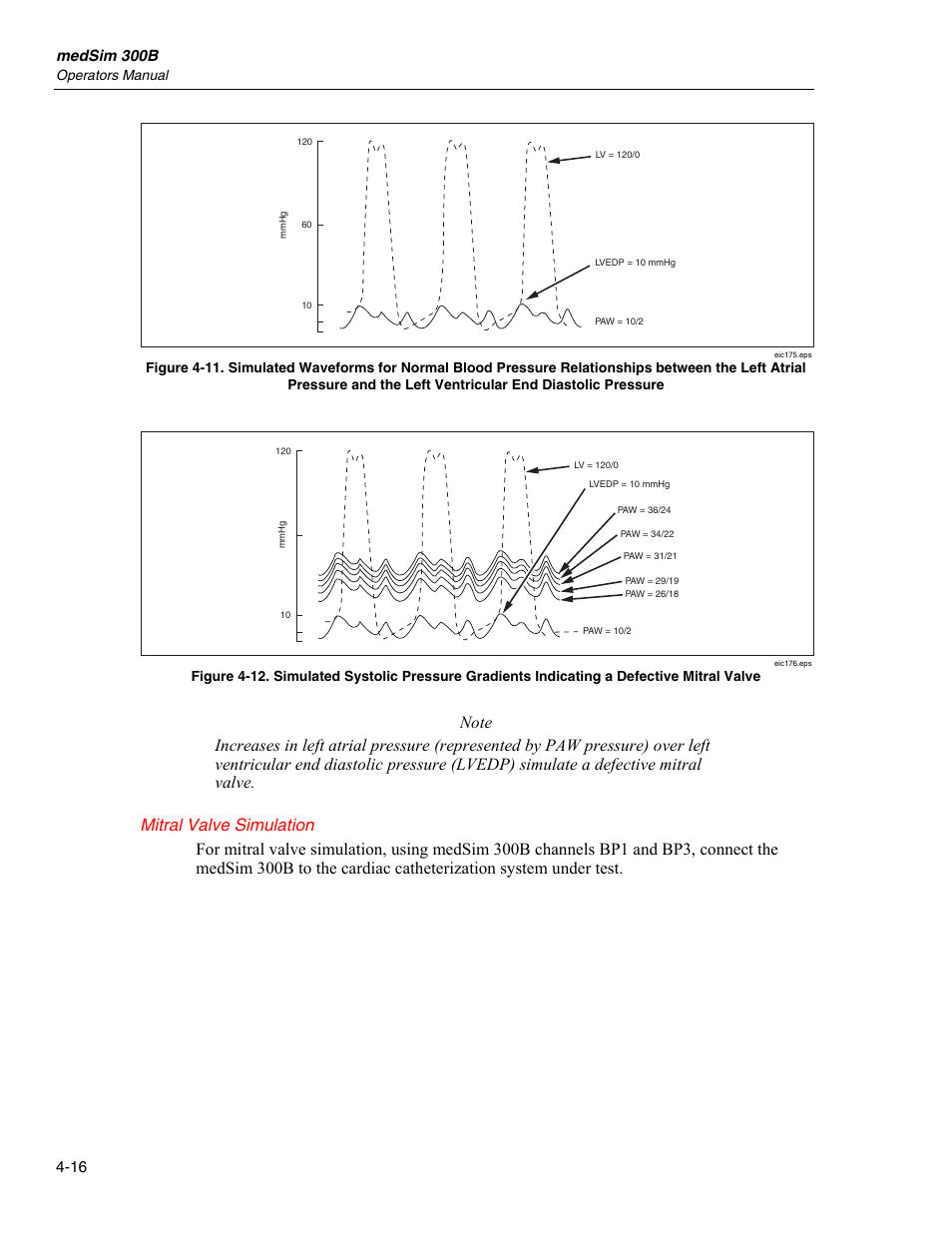 Mitral valve simulation | Fluke Biomedical medSim 300B User Manual | Page 114 / 158