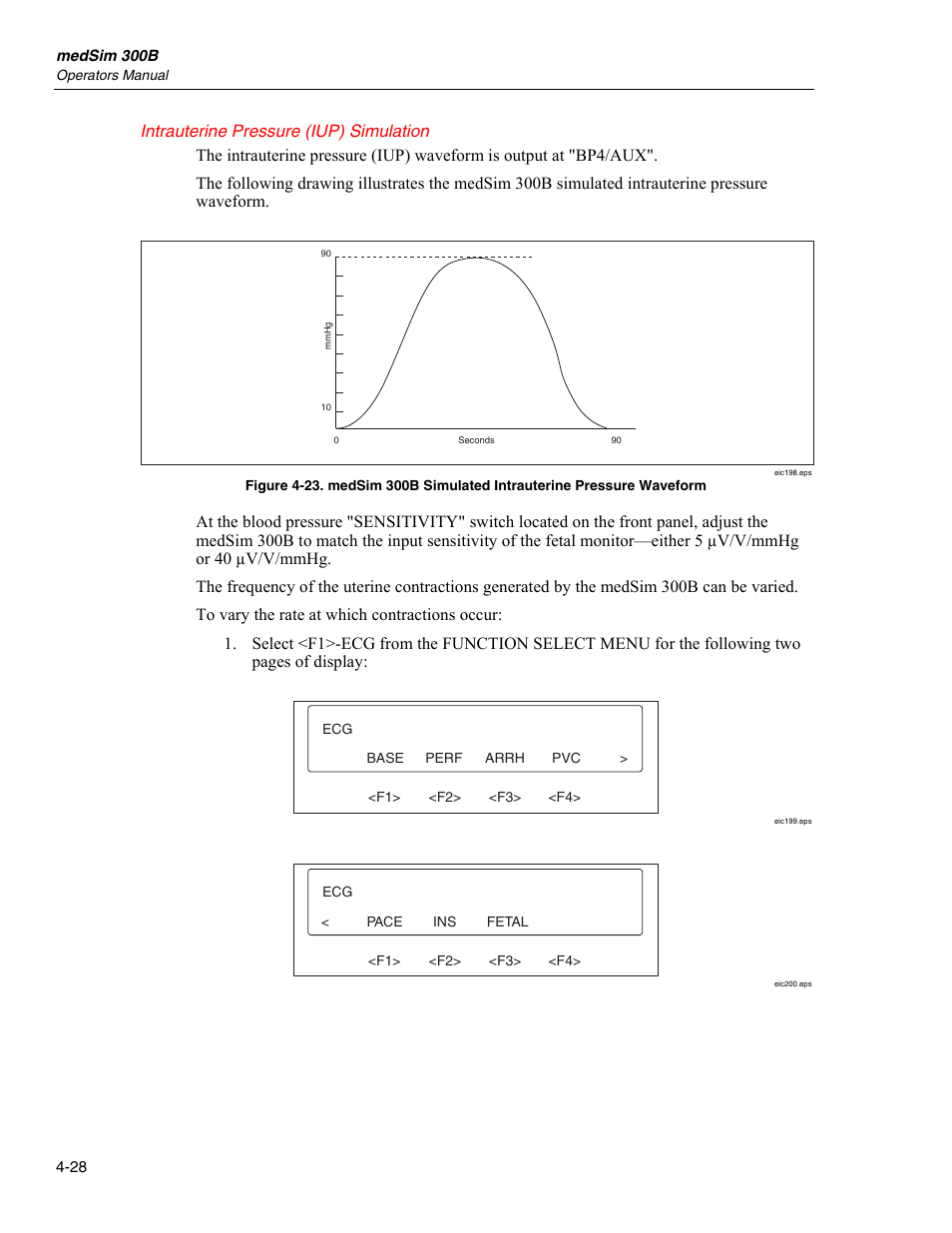 Intrauterine pressure (iup) simulation | Fluke Biomedical medSim 300B User Manual | Page 126 / 158