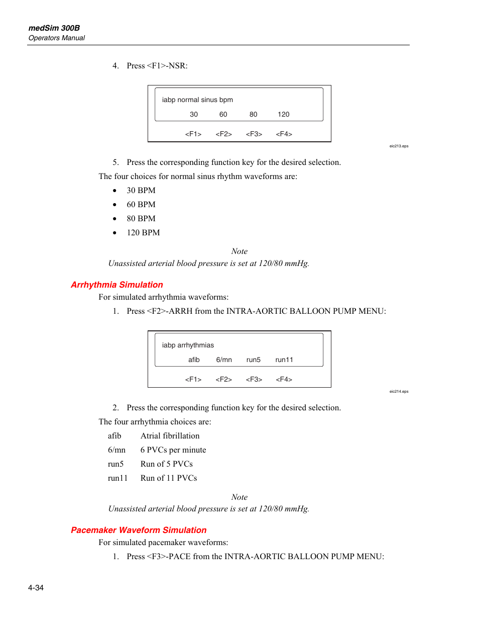 Arrhythmia simulation, Pacemaker waveform simulation | Fluke Biomedical medSim 300B User Manual | Page 132 / 158