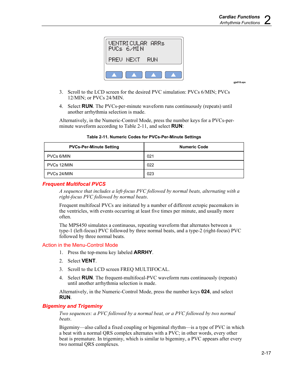 Frequent multifocal pvcs, Bigeminy and trigeminy | Fluke Biomedical MPS450 User Manual | Page 49 / 126